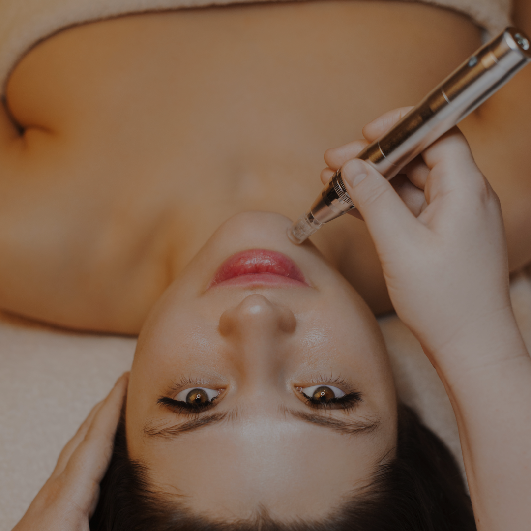 Microneedling Treatment