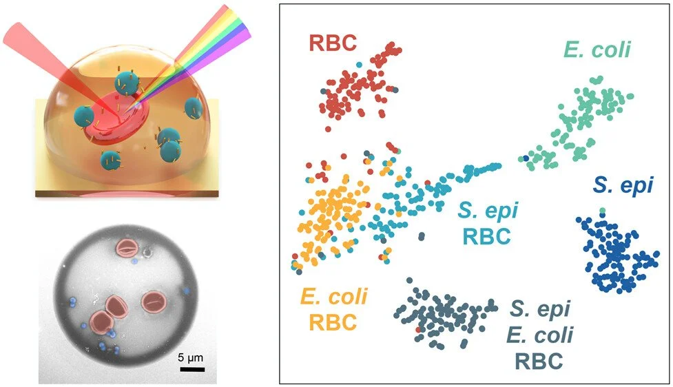 Combining Acoustic Bioprinting with AI-Assisted Raman Spectroscopy for High-Throughput Identification of Bacteria in Blood