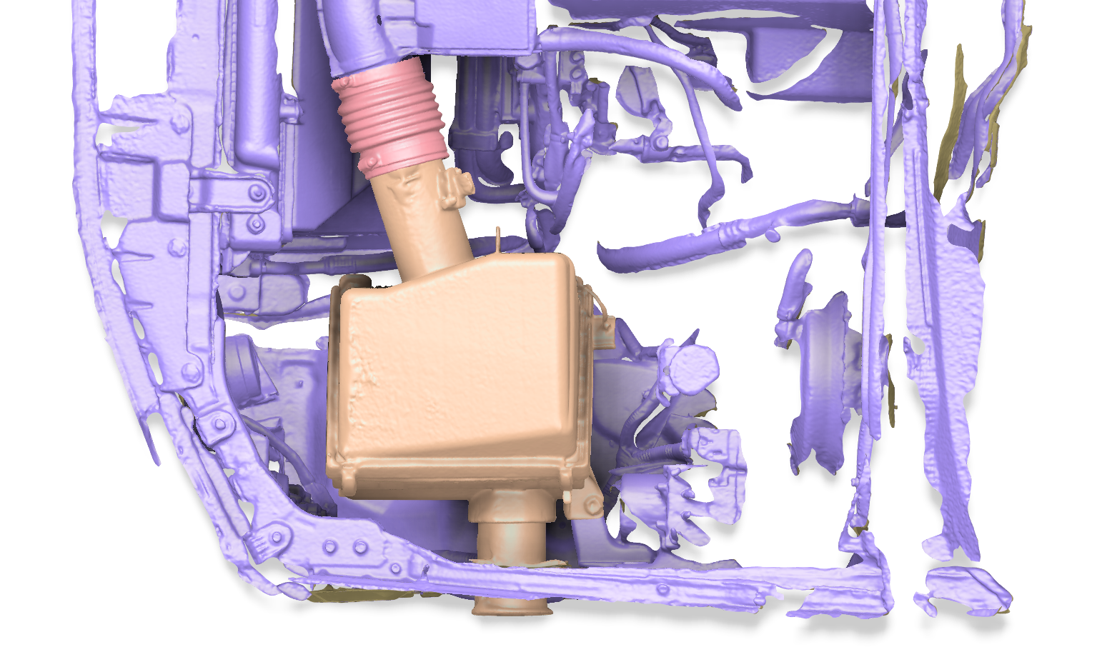 A detailed 3D medical scan of the interior of a human chest, showing various organs, blood vessels, and medical devices in different colors.