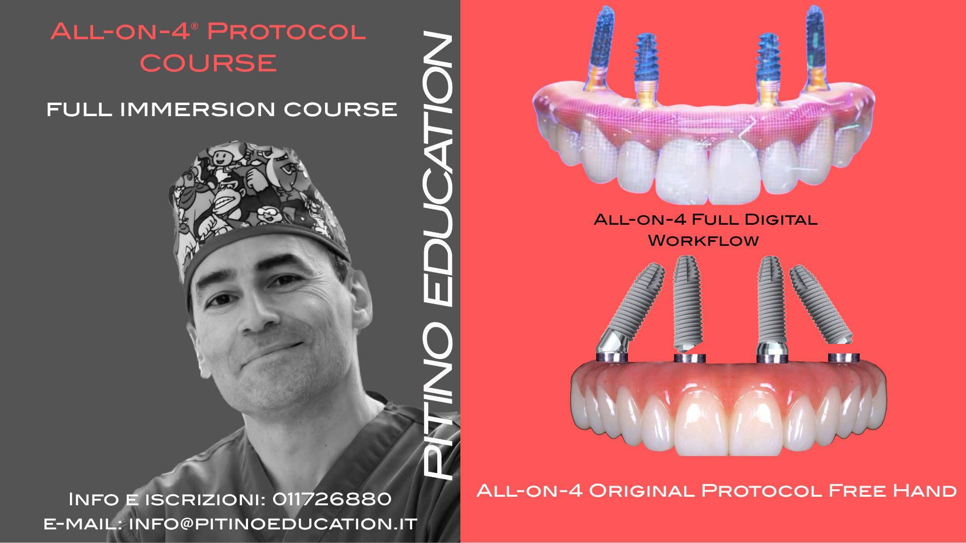 All-on-4® Full Digital Workflow – Advanced Course