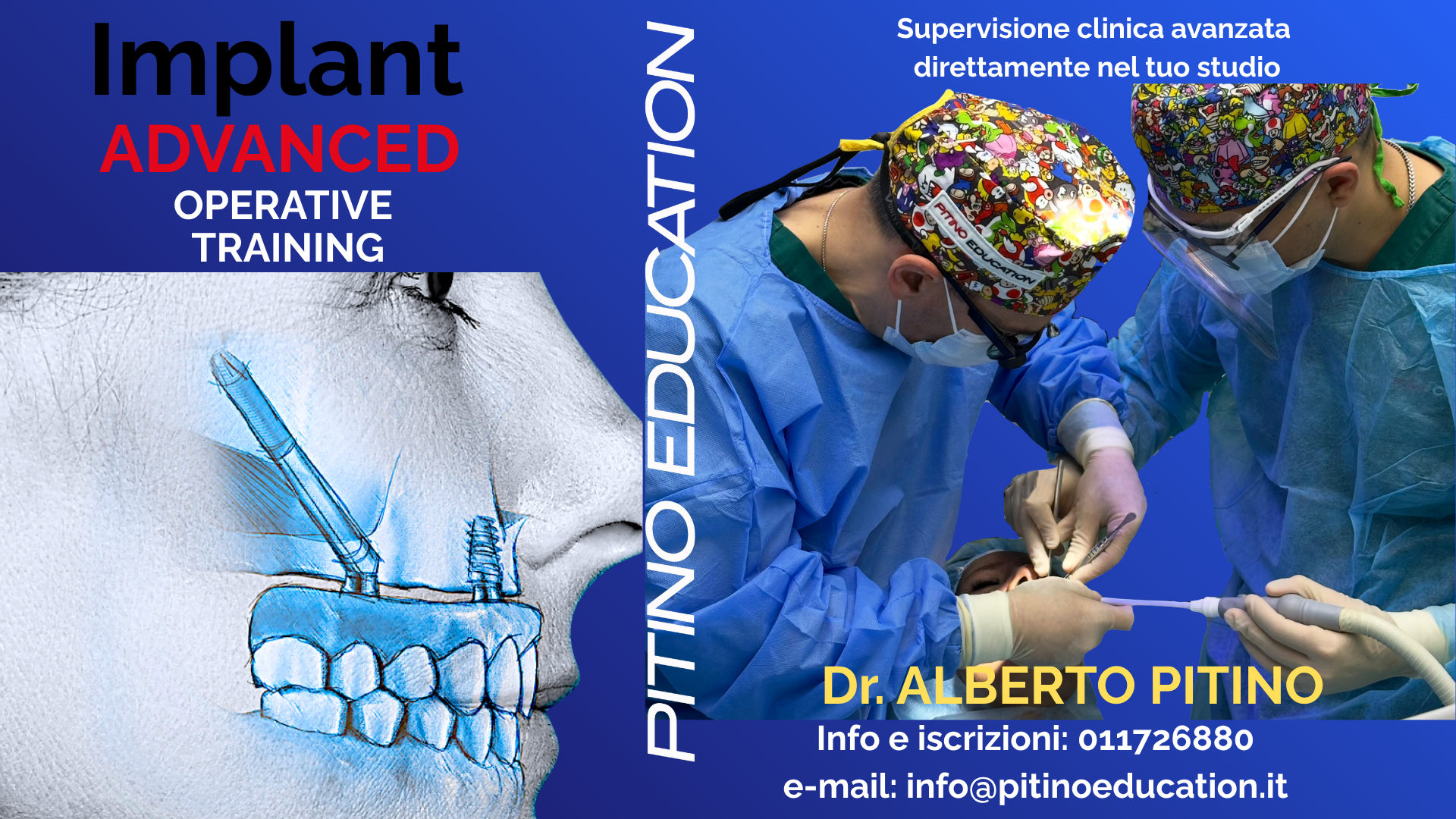 Implant Advanced Operative Training