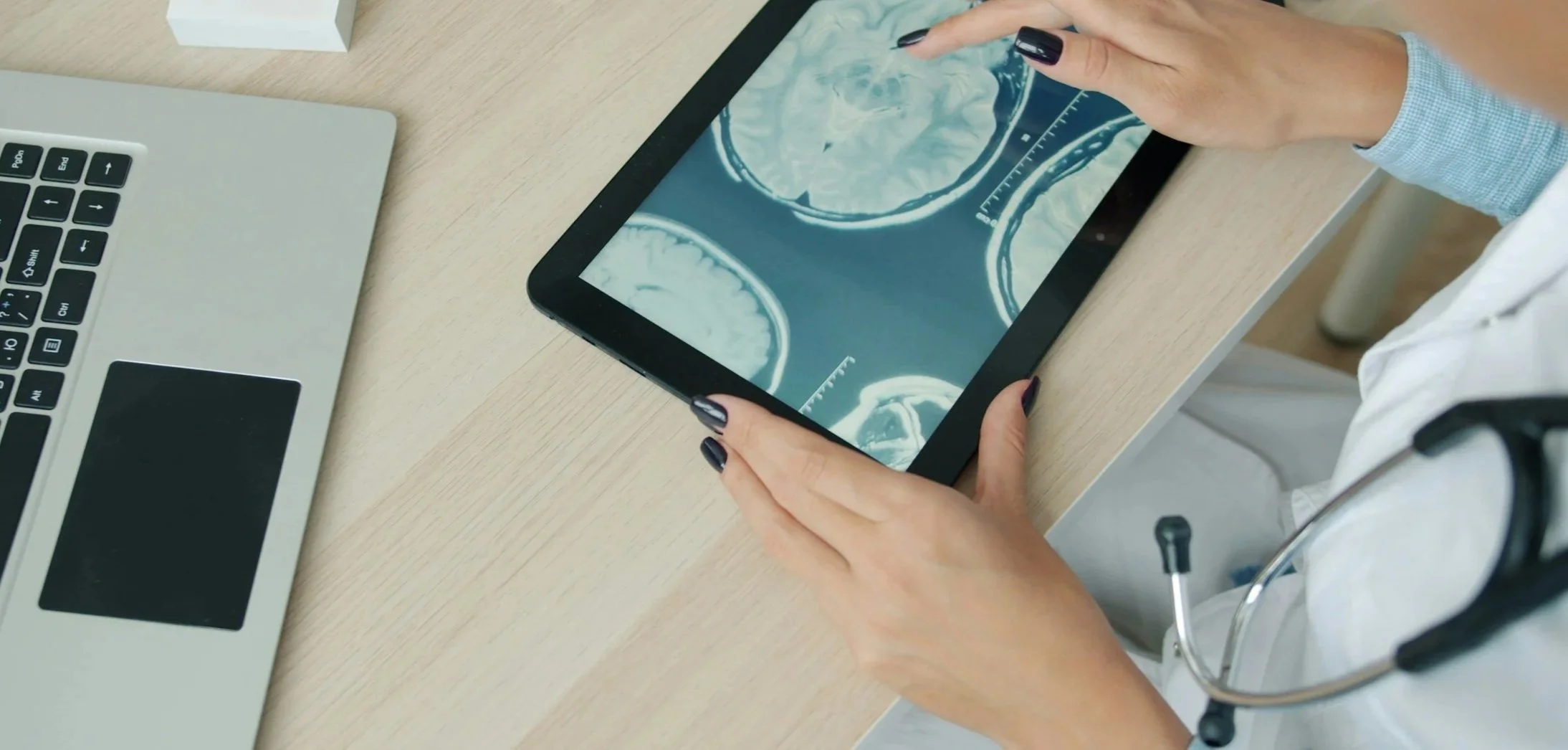A person in a white medical coat and stethoscope examining MRI brain scans on a tablet device, with a laptop on the desk nearby.