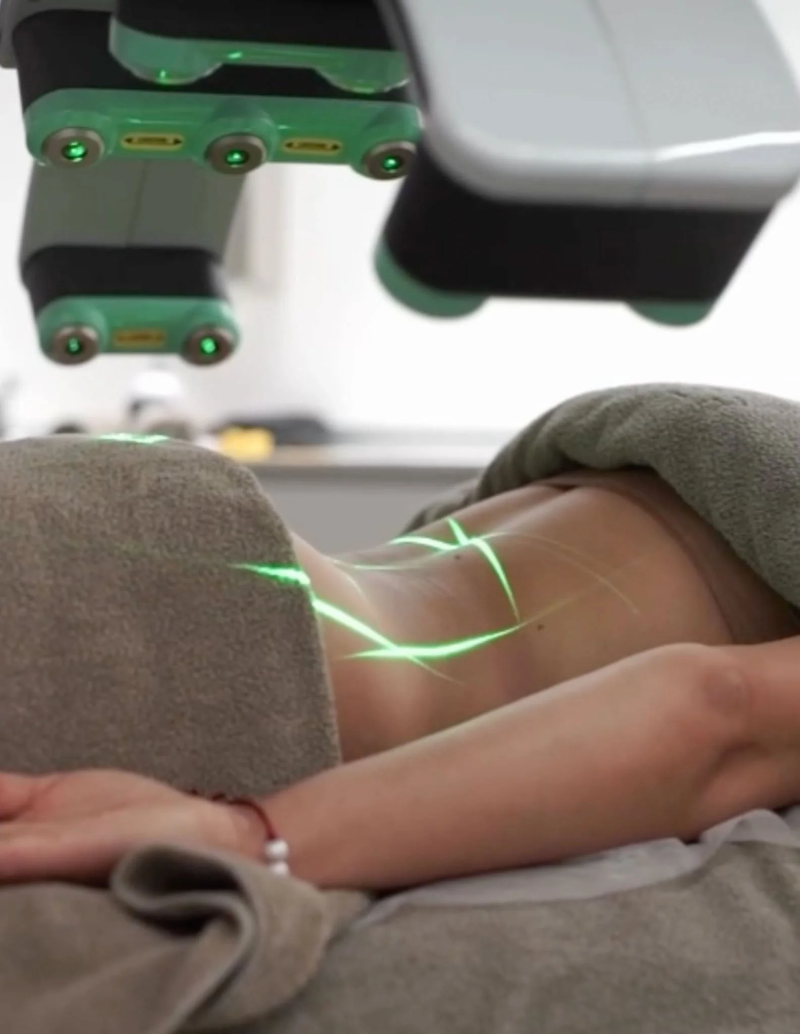 What to Expect During Your First Emerald Laser Session