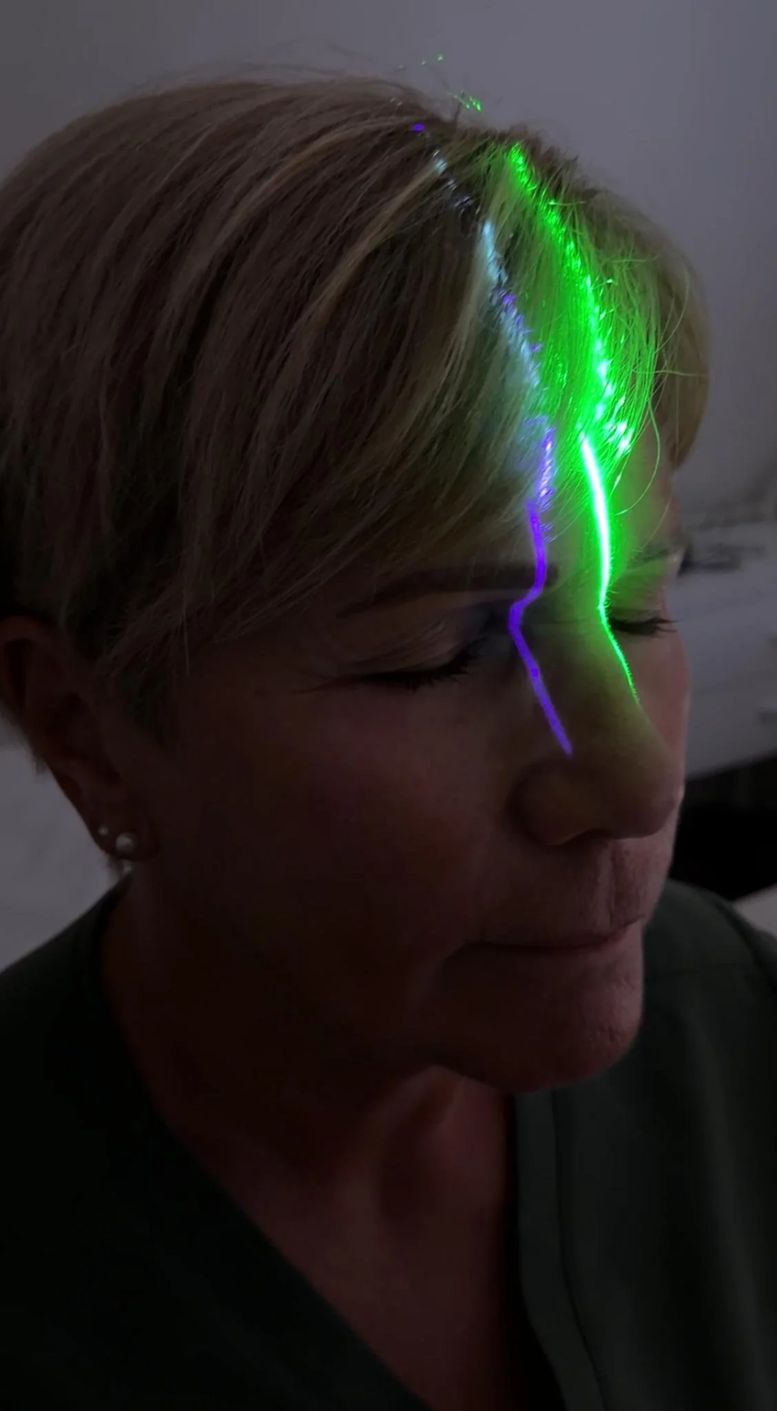 Why Our Lasers Are Different