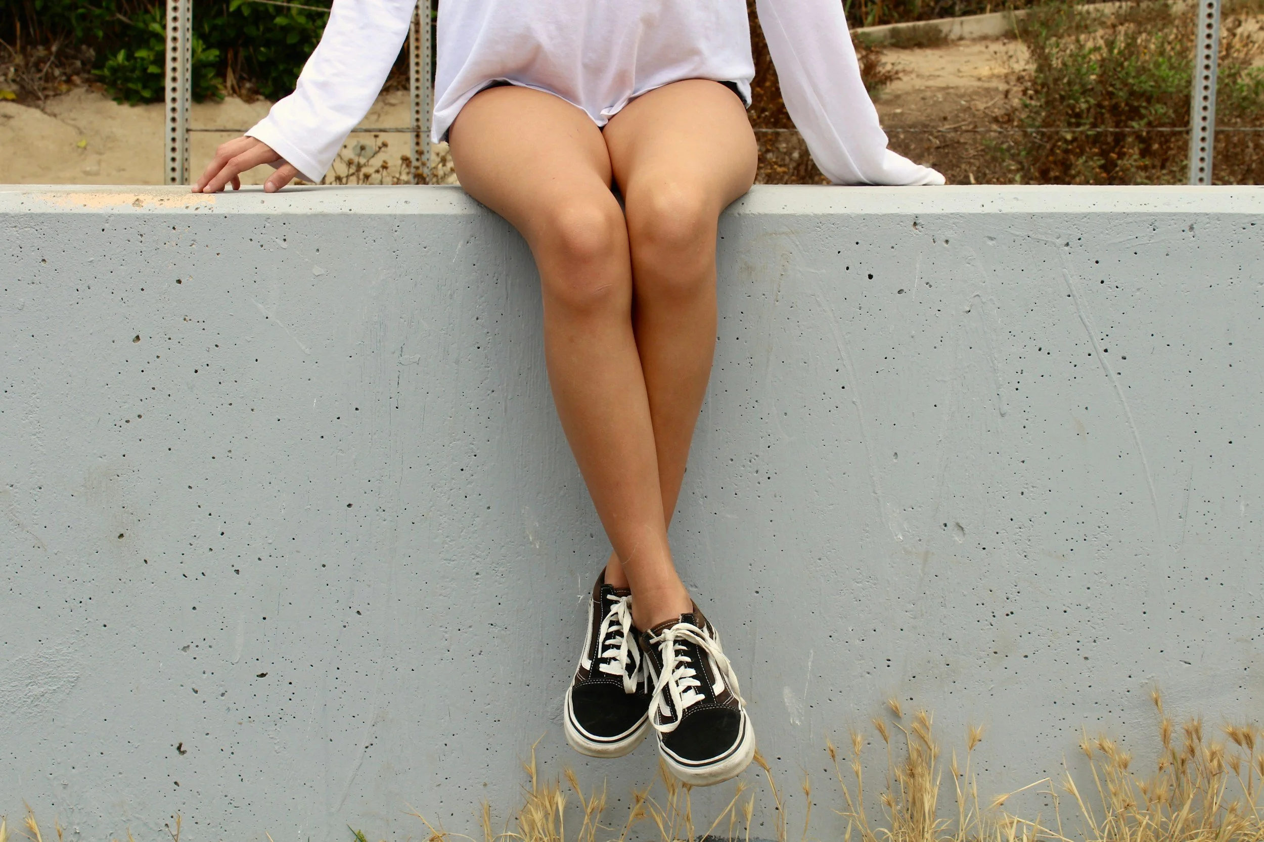 Varicose Veins &amp; Sclerotherapy
