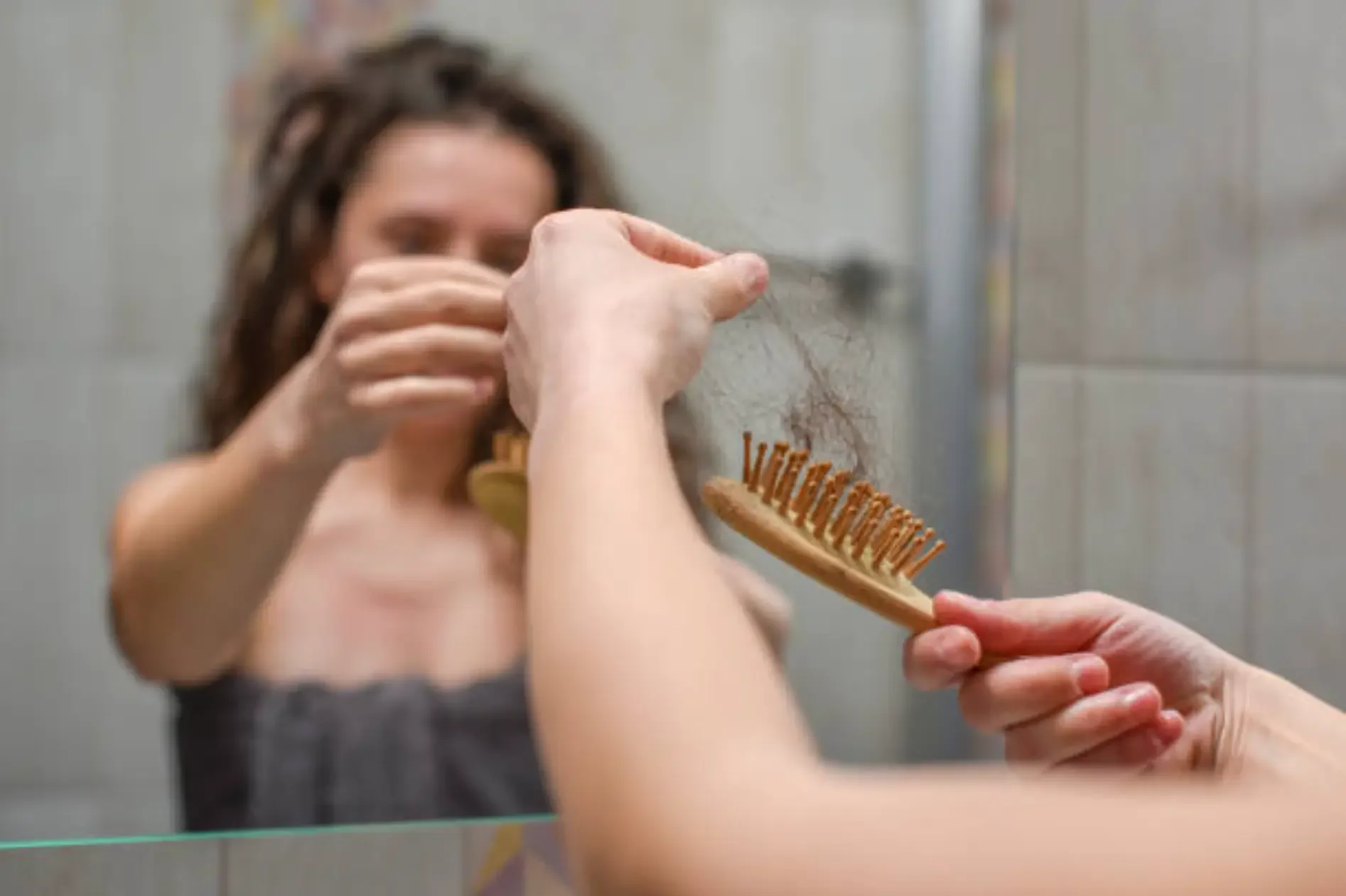 Hair Loss for Women