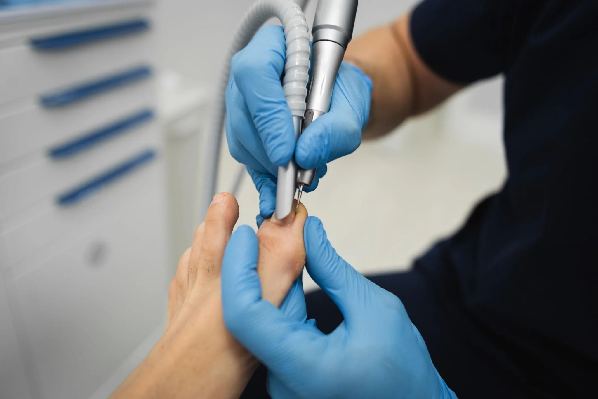 Nail care during mobile foot care visit