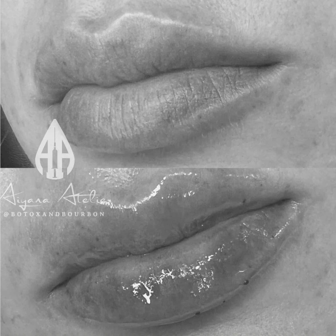 Close-up of lips with gloss, black and white photo, with a logo in the bottom left corner.