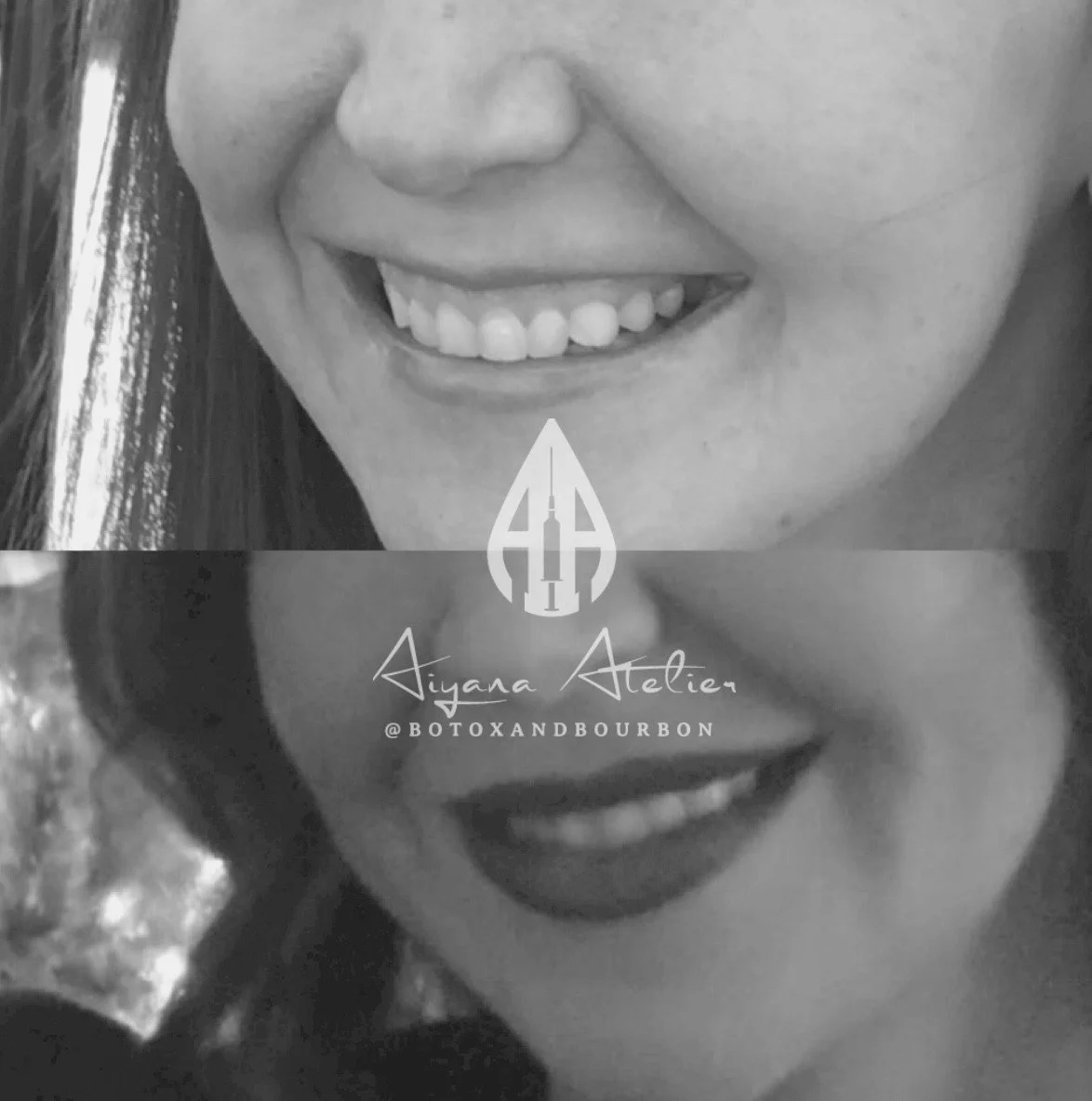 Black and white collage of smiling women, one with visible teeth and lips, with text reading "Aiyana Atelier @BOTOXANDBOURBON".