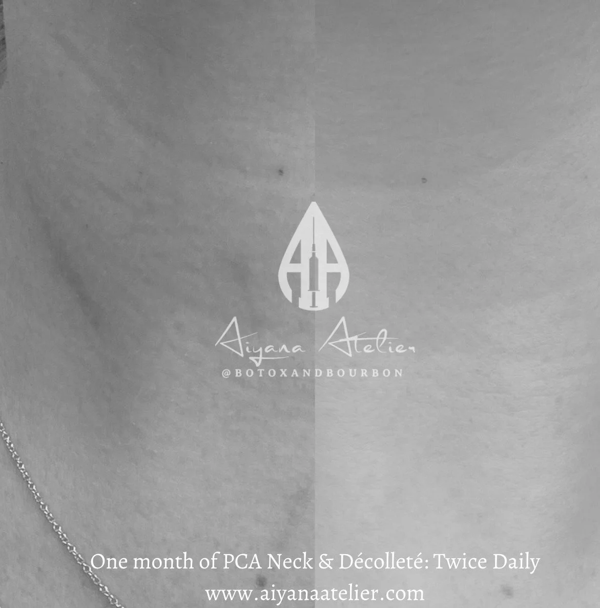 Close-up of a woman wearing a delicate chain necklace, with a subtle logo and text overlay related to Aiyana Atelier and skincare products, emphasizing twice-daily PCA Neck & Décolleté routine.