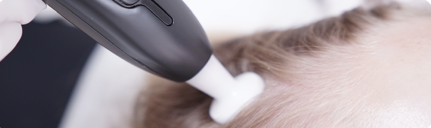 A person receiving a cosmetic or medical treatment on their scalp using a handheld device emitting a white foam or liquid.