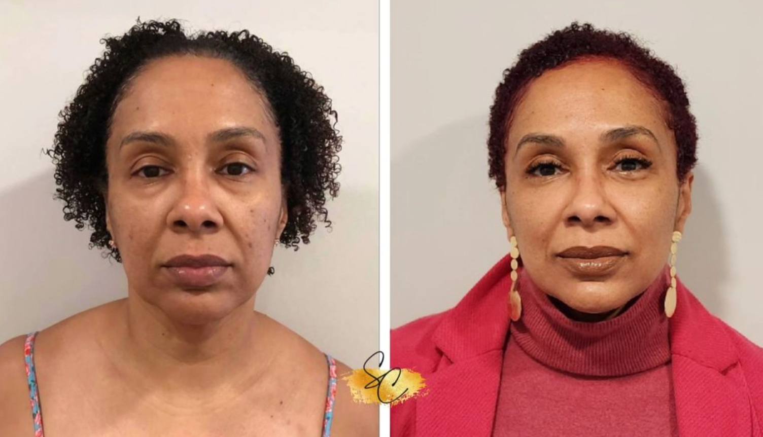 Side-by-side portrait photos of a woman before and after a transformation, showing improved skin, styled hair, and makeup.