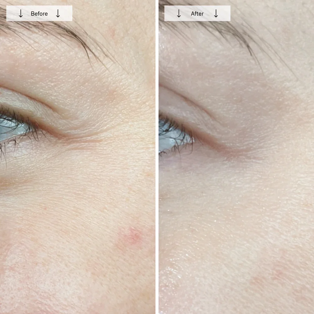 omnilux countour face 12.webp