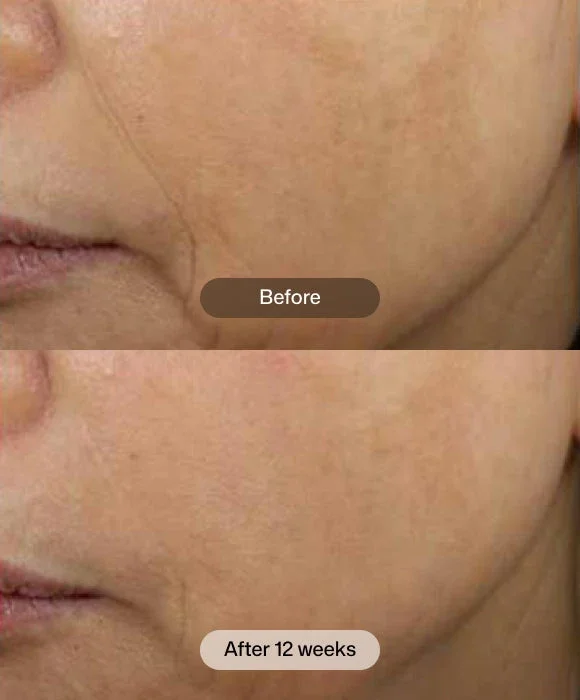 d-e-j-face-cream-7_60fc12d5-7c00-44ca-b449-fbcfcad87869.webp