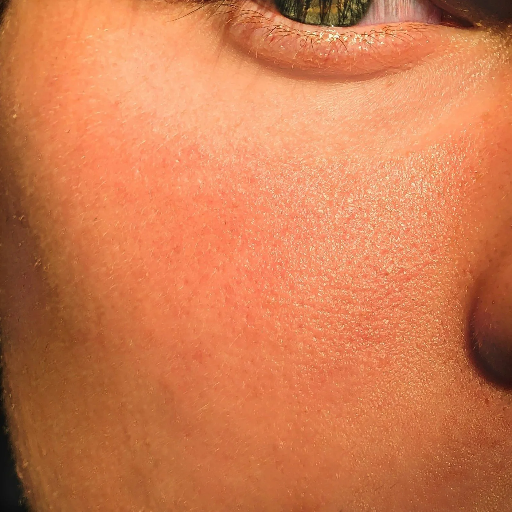 Close-up of a person's face showing the cheek area and part of the eye.