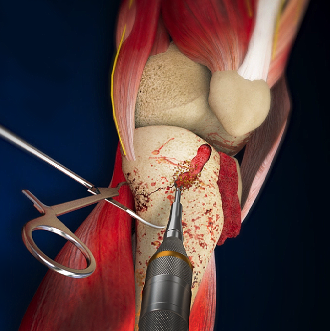 Intermediate Service