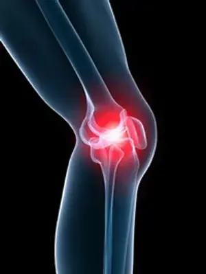 A digital illustration of a human knee joint with inflammation or pain marked by a red glow.