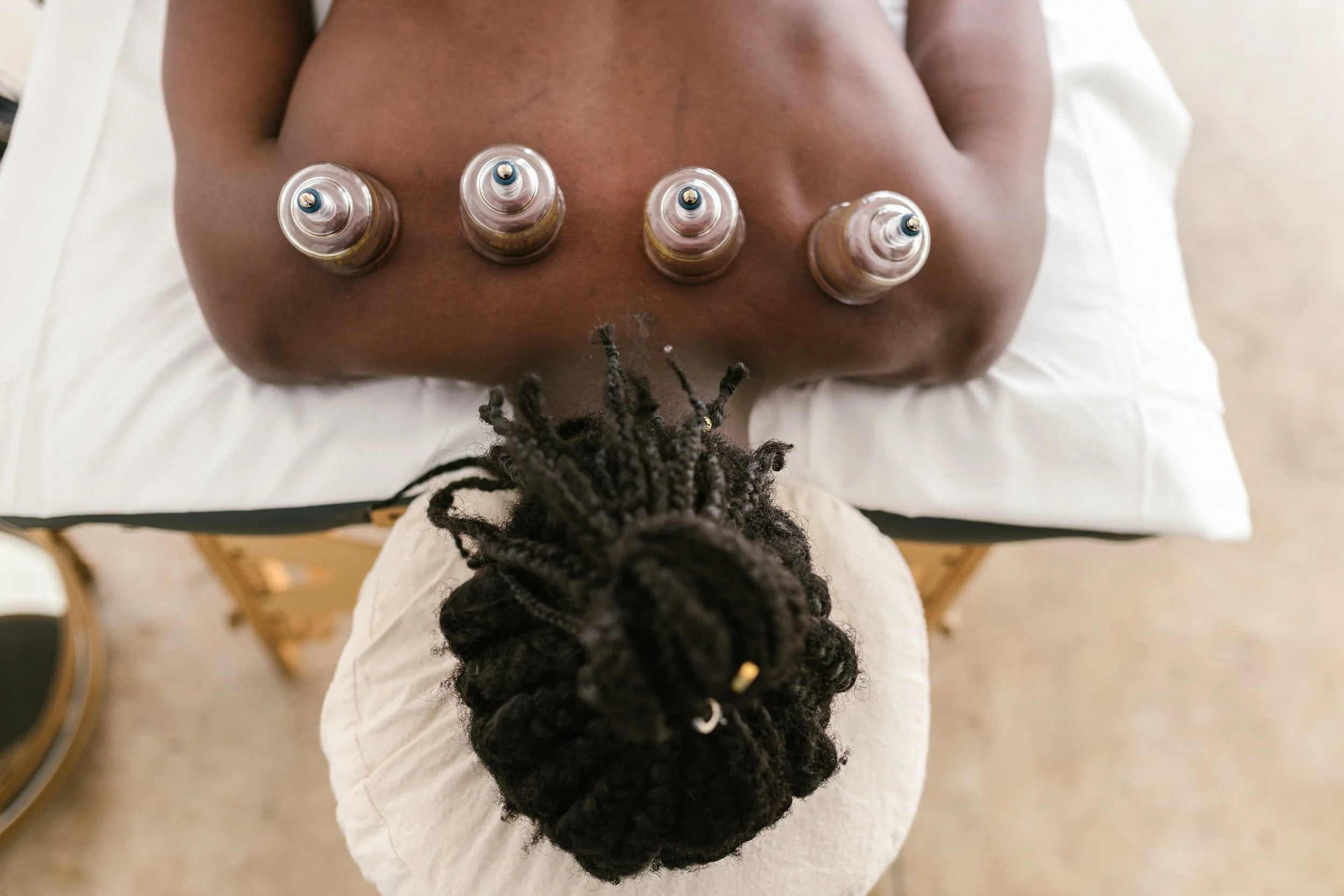 A Black person lying face down on a massage table receiving fire cupping on their back with four cups horizontal along the top of their back.