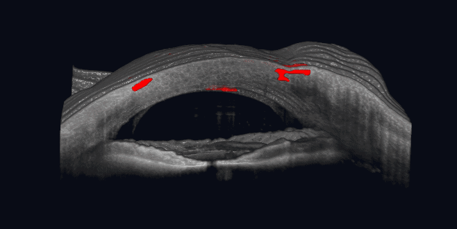 A 3D ultrasound image of a fetus in the womb, showing the head and facial features.