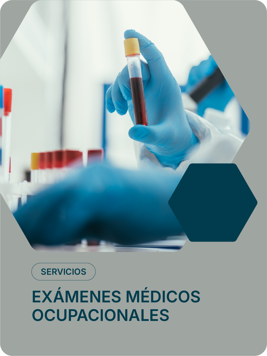 Mano con guantes azules sosteniendo tubo de ensayo con muestra de sangre en laboratorio.