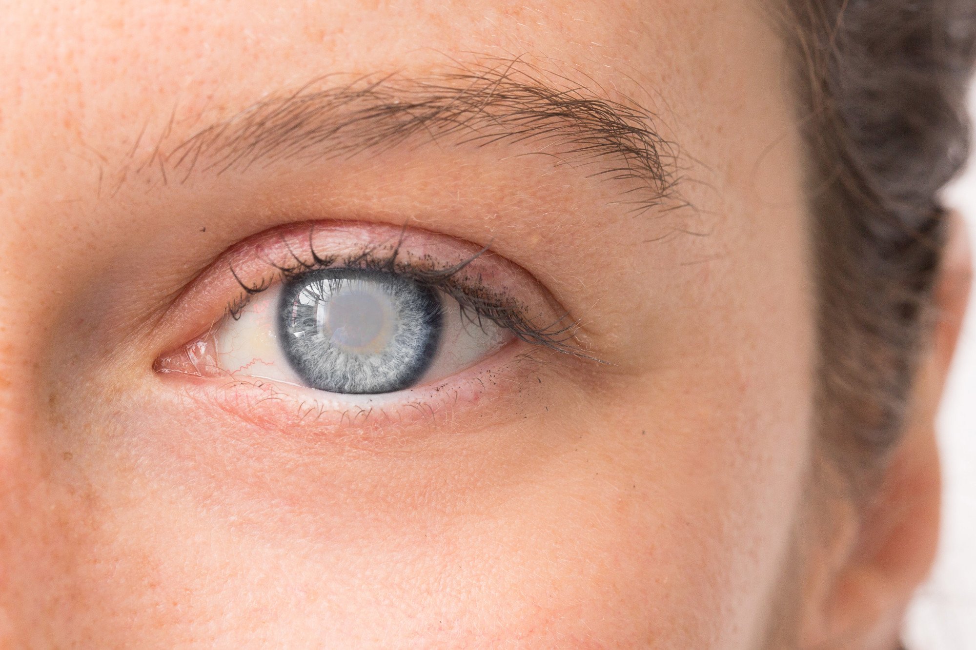 Close-up of a person's eye with blue iris, surrounded by skin, brow, and eyelashes.