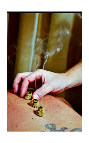 Moxibustion therapy