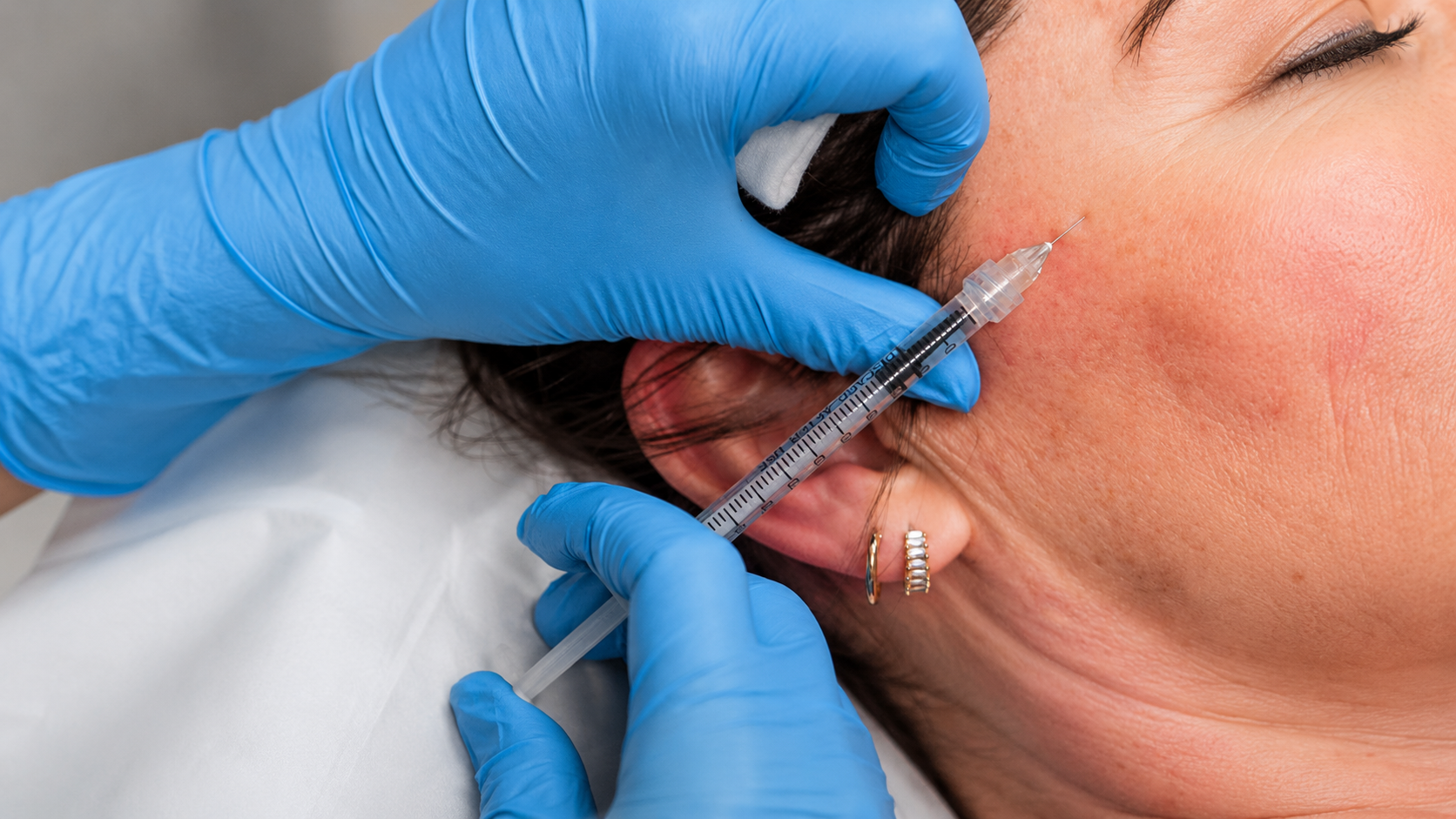 A person with earrings receiving an injection or cosmetic treatment near the ear from a healthcare professional wearing blue gloves.