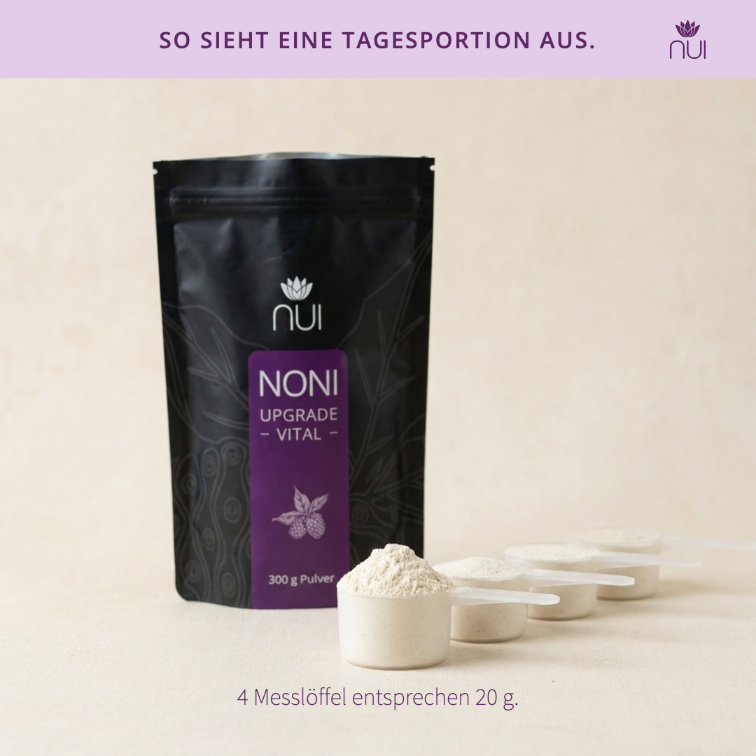 NUI Upgrade Vital – persönlicher Favorit von Gabriele Heinzle