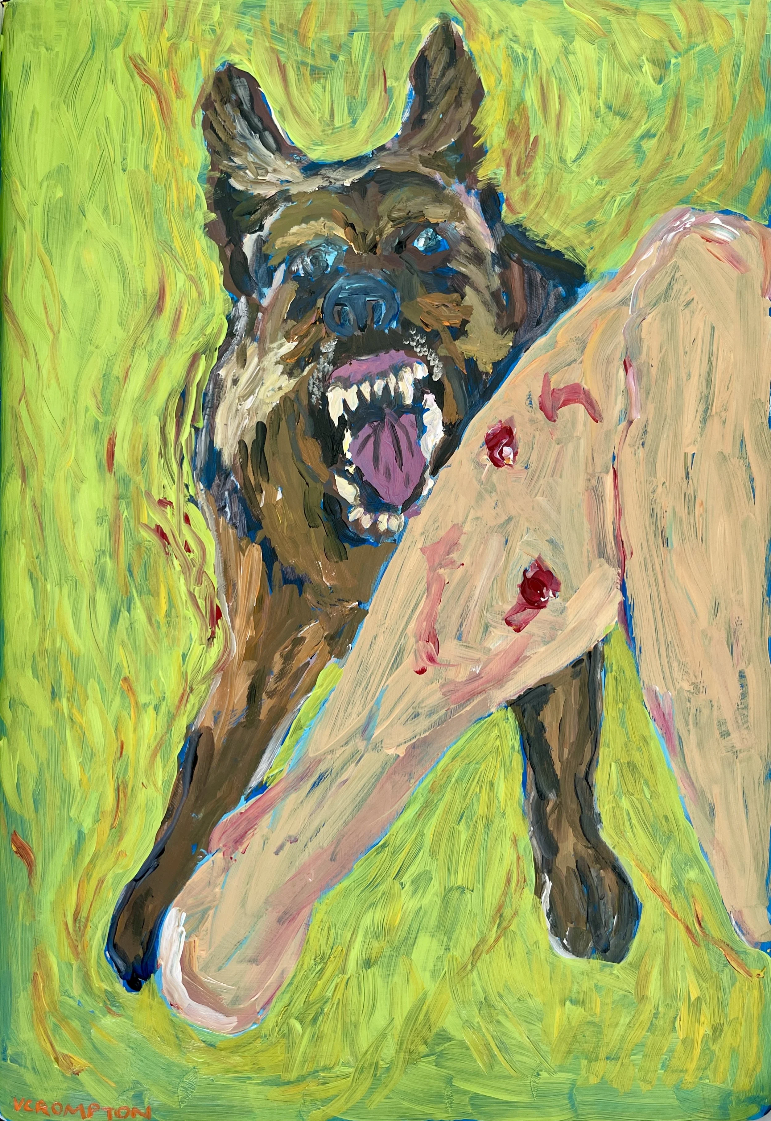*NEW* Experience I: Dog Bite (2)