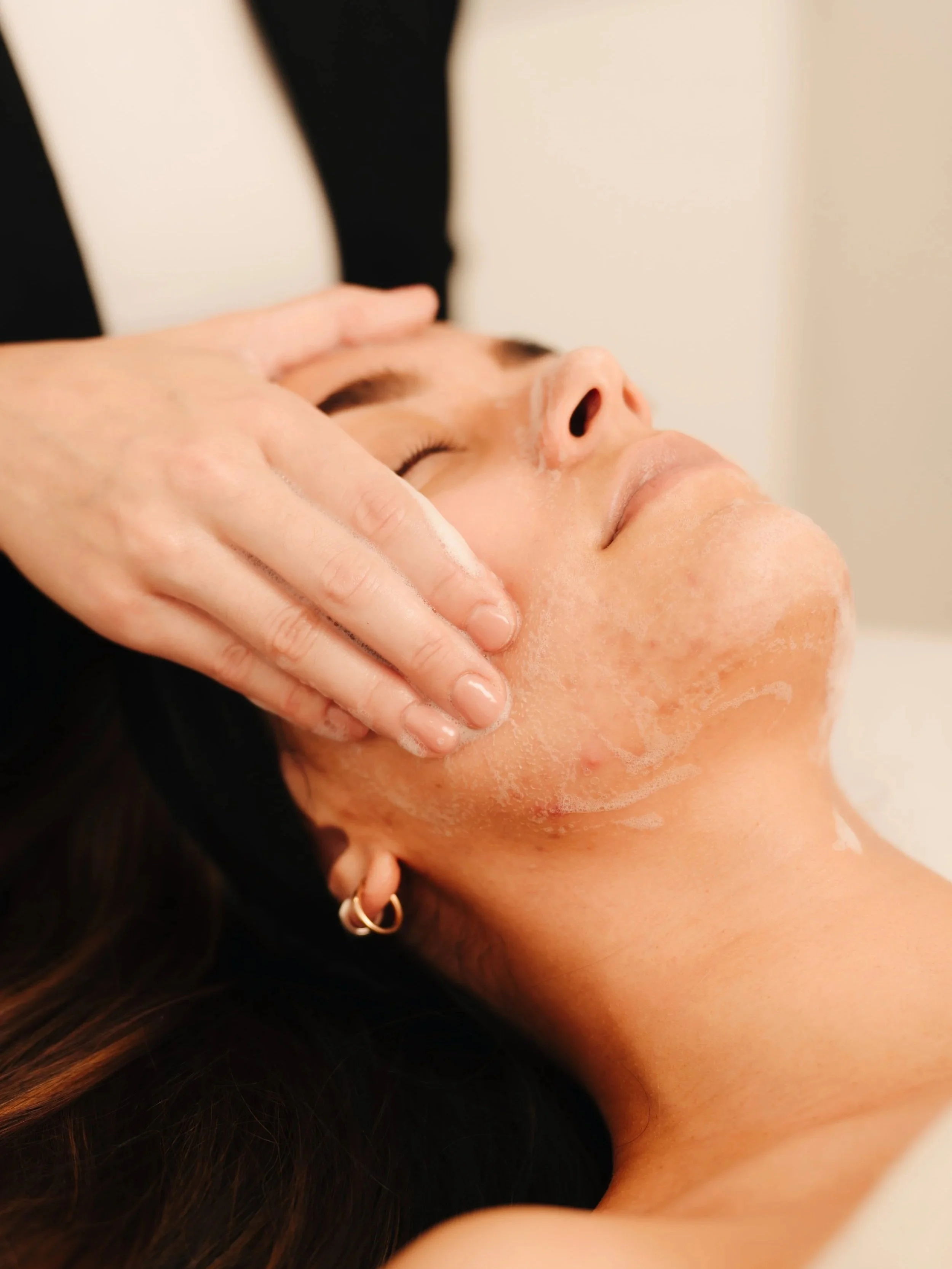 Adult Female Acne: Why It's Rarely Just a Skincare Problem