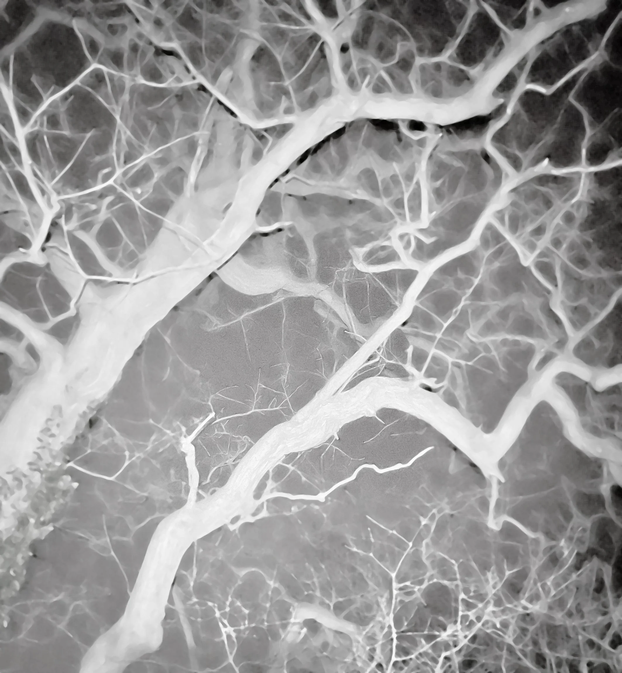 Bare branches torchlit night painterly Dec 24.jpg