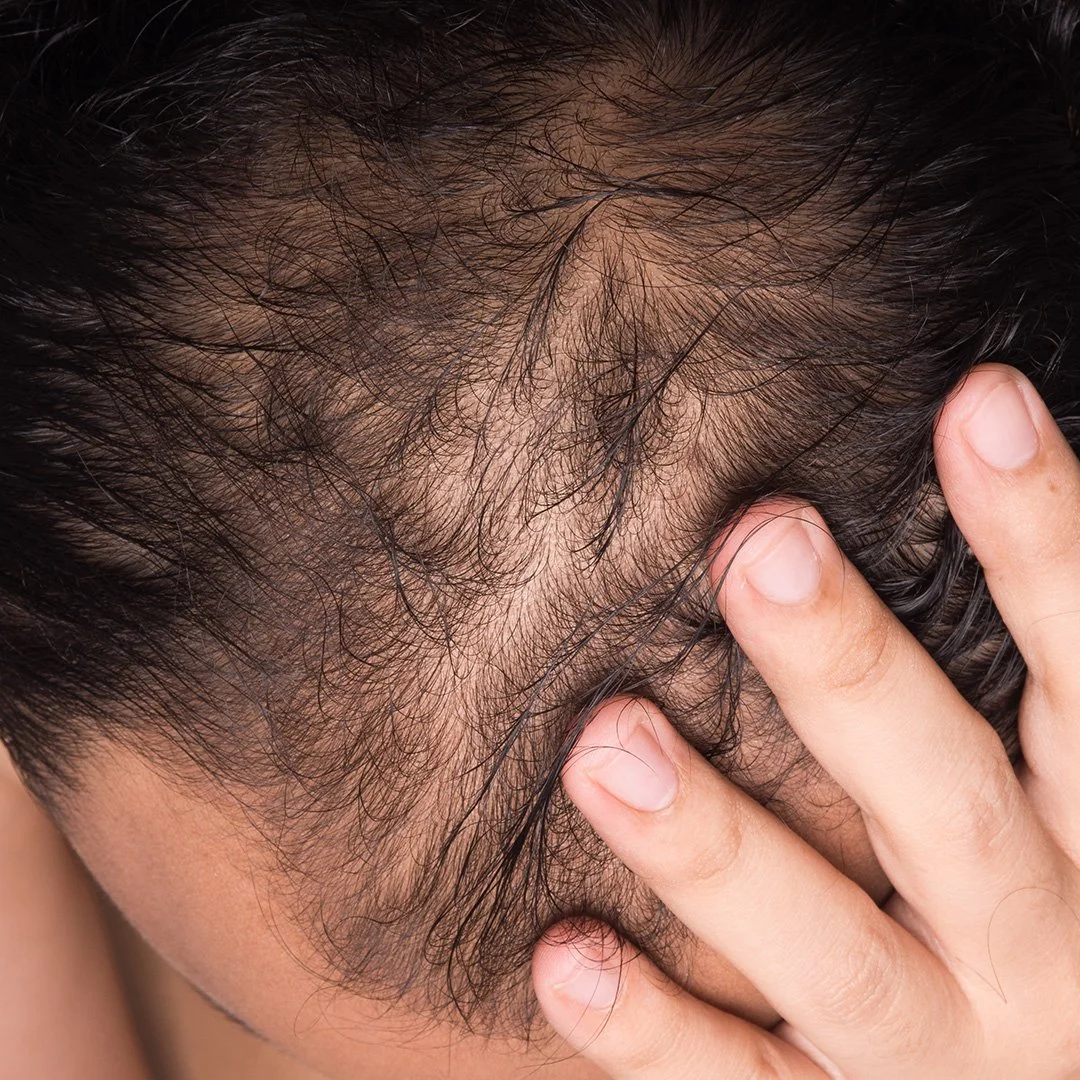 Close-up of a person with dark hair, showing the scalp and hairline. A hand with light skin and neatly trimmed nails touches the hair.
