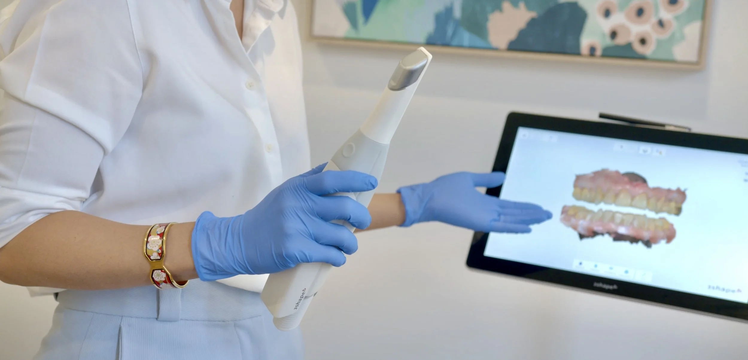 a sleep medicine dentist showing how a dental scan is made of a patient's teeth in a simple easy 3D scanning process that allows for custom fit comfortable oral appliances to be made in our melbourne based specialist lab