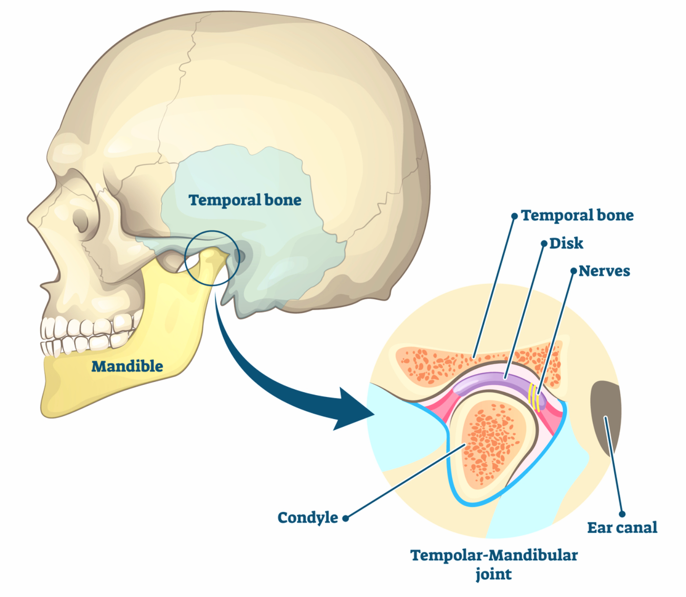 a diagram of the temporomandibular joint TMJ or TMD