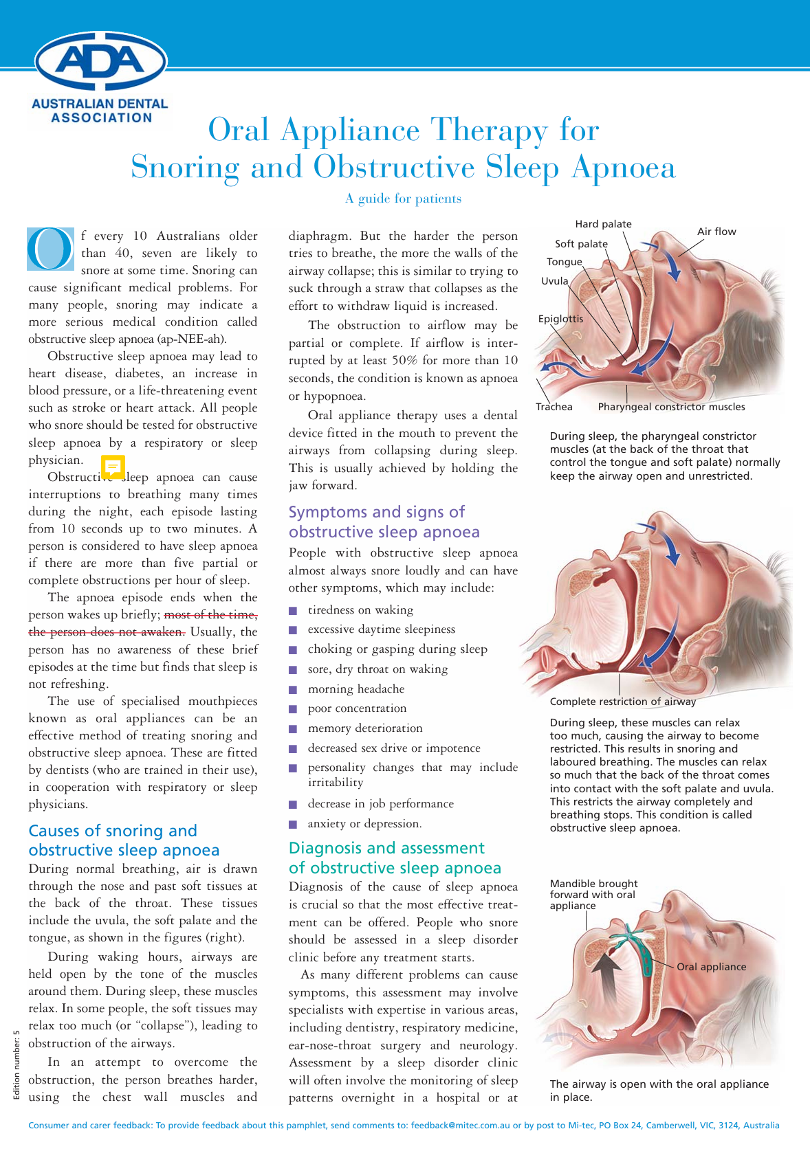 Australian Dental Association information sheet on oral appliance therapy for snoring and obstructive sleep apnoea for patient information and reading about snoring and how sleep apnoea can affect my health