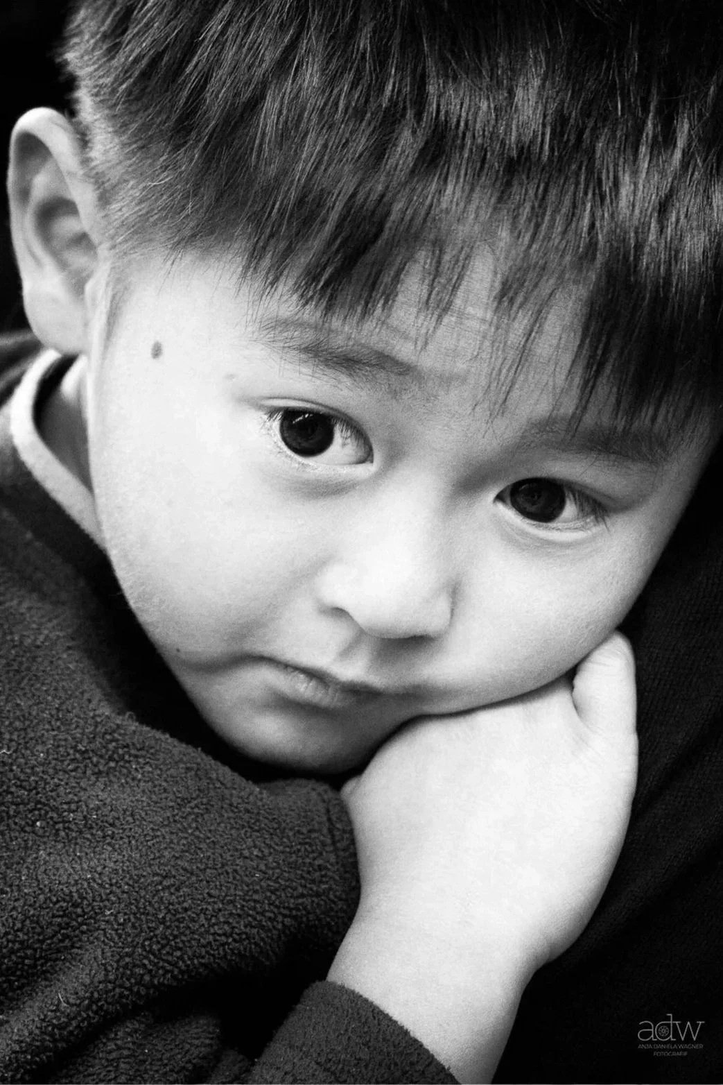 Close-up black and white photo of a young boy resting his face on his hand, with large eyes and short hair.