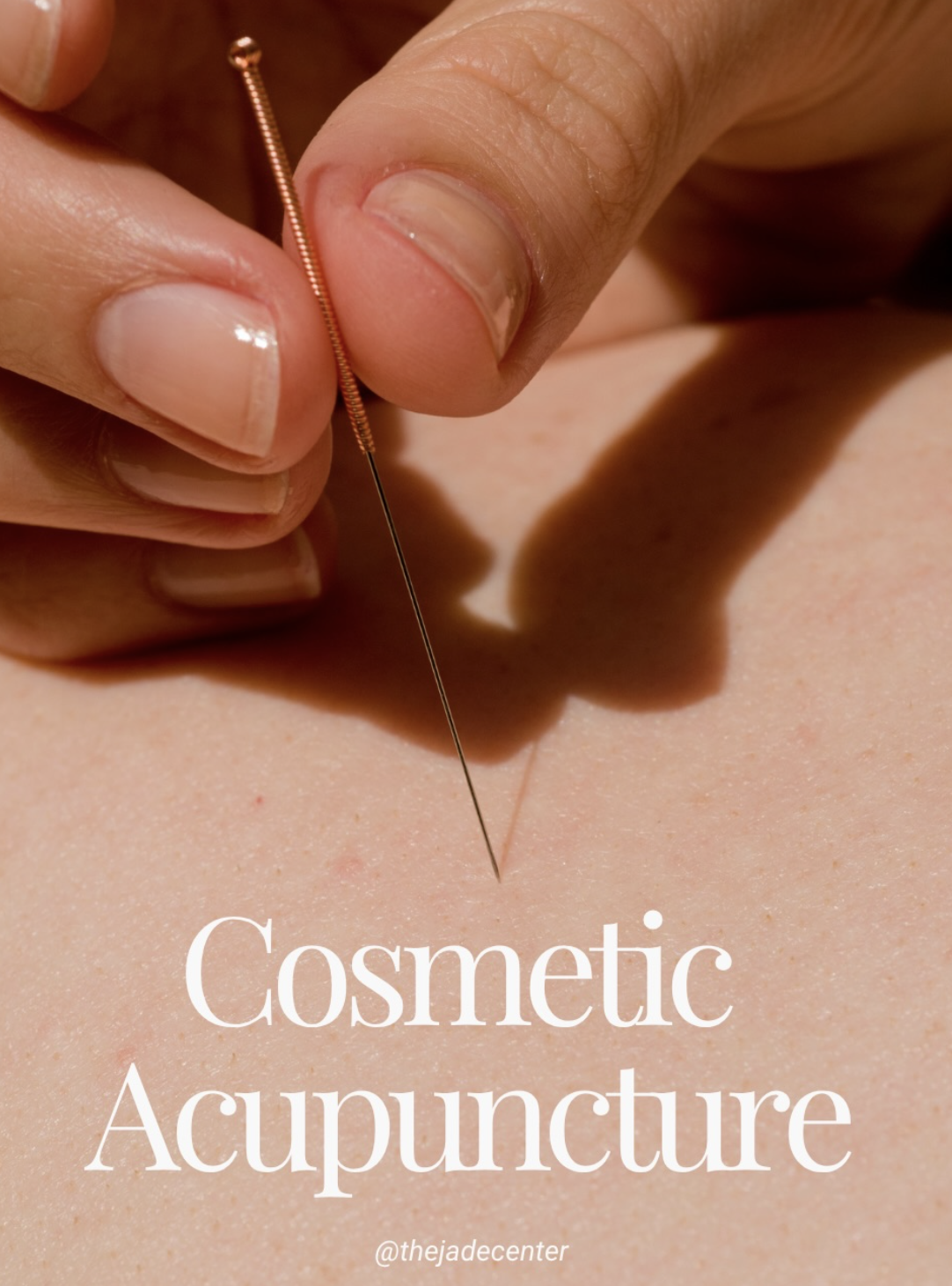 Close-up of a hand inserting an acupuncture needle into skin with overlay text 'Cosmetic Acupuncture' and Instagram handle '@thejadecenter'.
