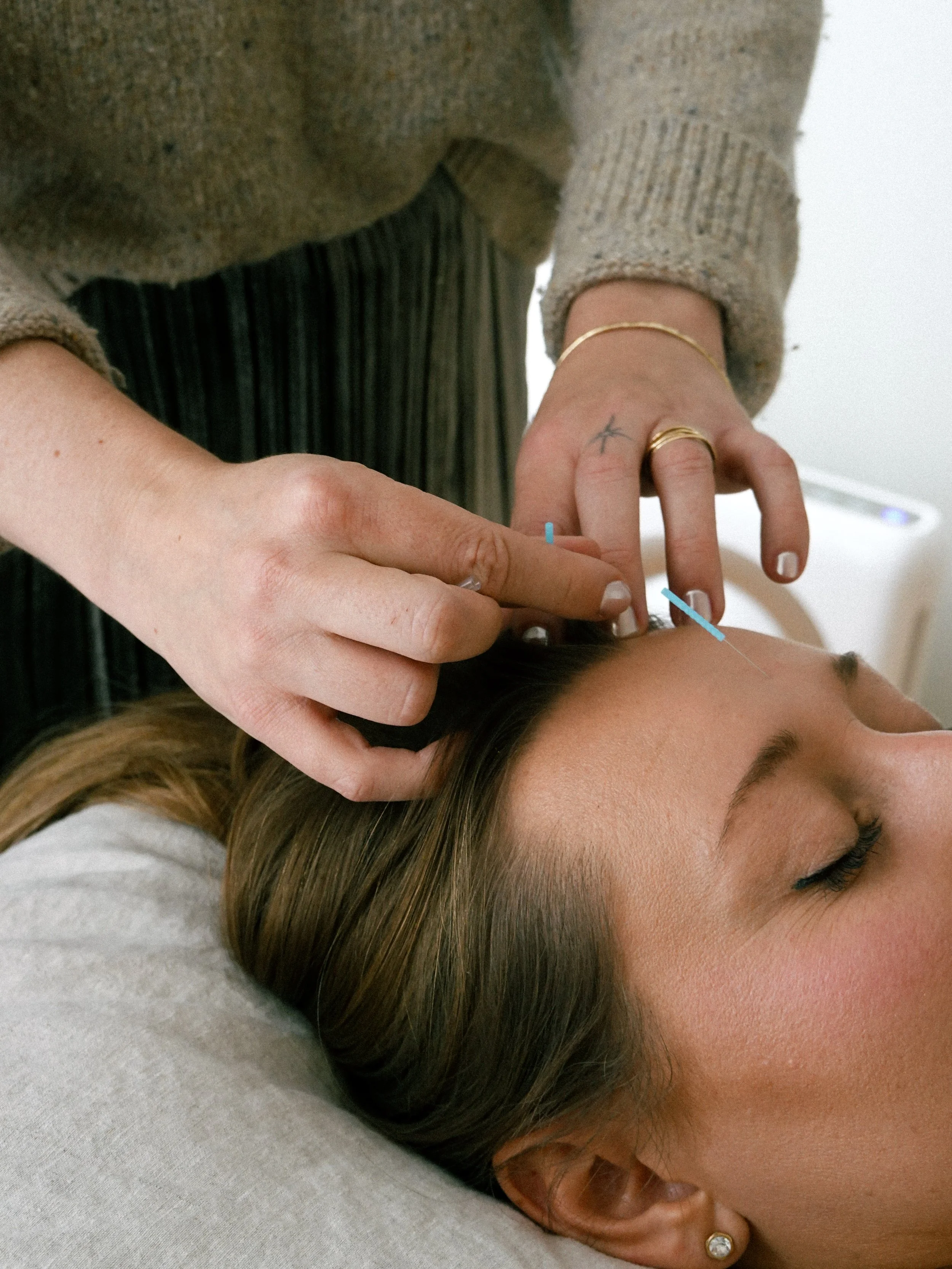 A person with fair skin and light brown hair lying on their side with eyes closed, getting a medical procedure using a thin needle with blue markings on the tip, near their face and ear. The person's face has a small earring with a clear gemstone. The person is wearing a gray textured sweater, and the background is light-colored.