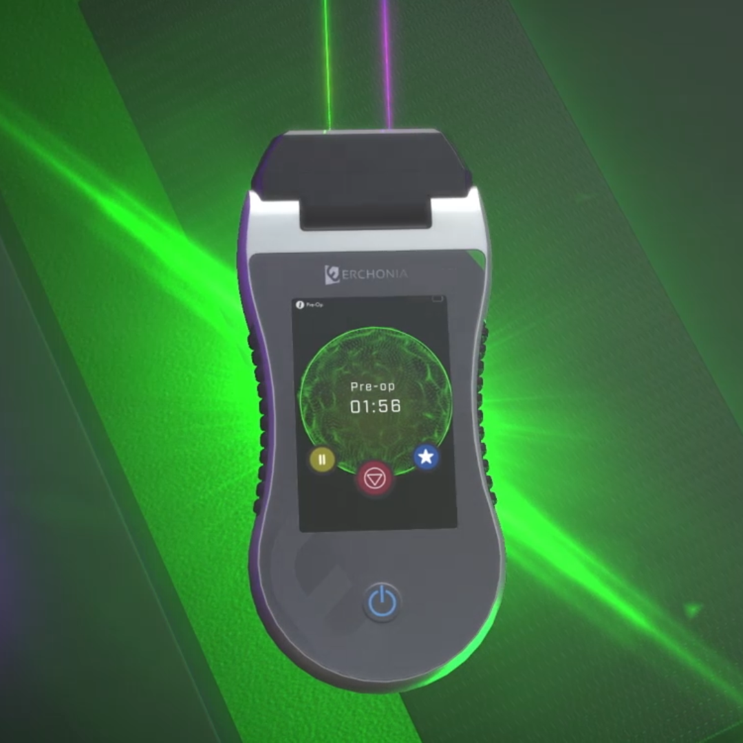 A handheld portable device with a screen displaying a glowing green sphere and the text 'Pre-op 01:56'. The device is branded 'ERCHONIA' and is surrounded by green and purple laser lights.