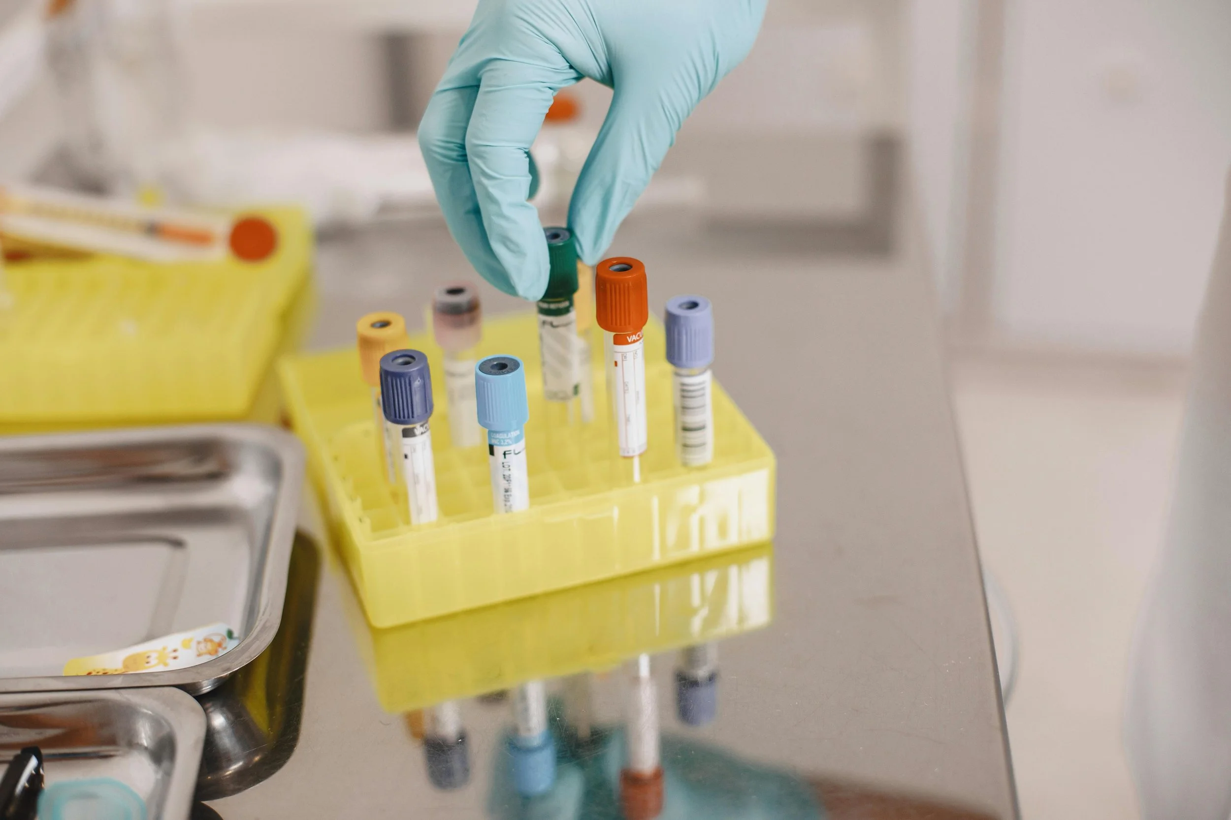 A hand in a blue glove reaching for a blood sample vial on a yellow rack, with other sample vials nearby in a laboratory setting.