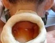 Close-up of a person holding a dough ring with a peeled tomato or similar inside the hole