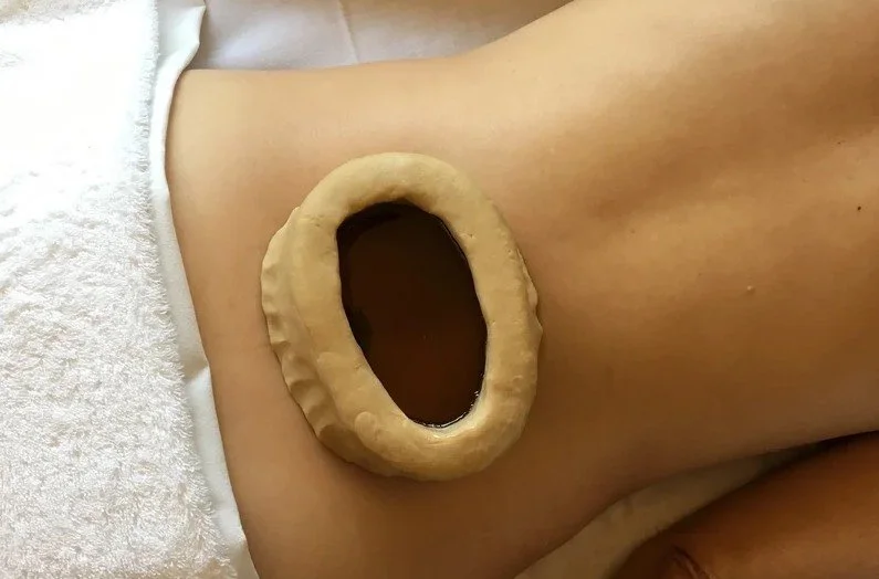 A beige donut-shaped object placed on a person's side near their waist, with a dark liquid inside.