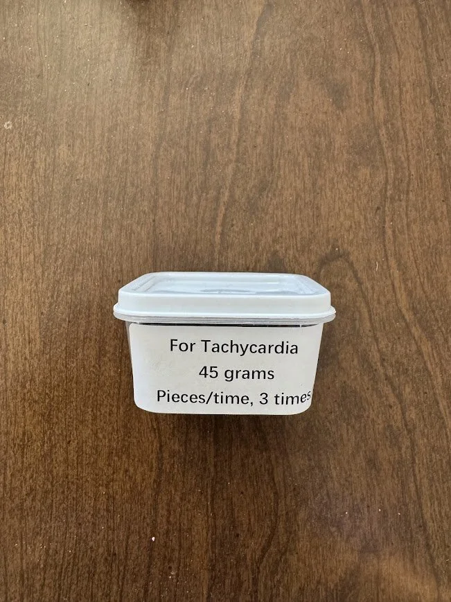 Tachycardia
