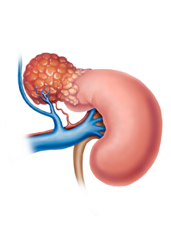 Adrenal Surgery