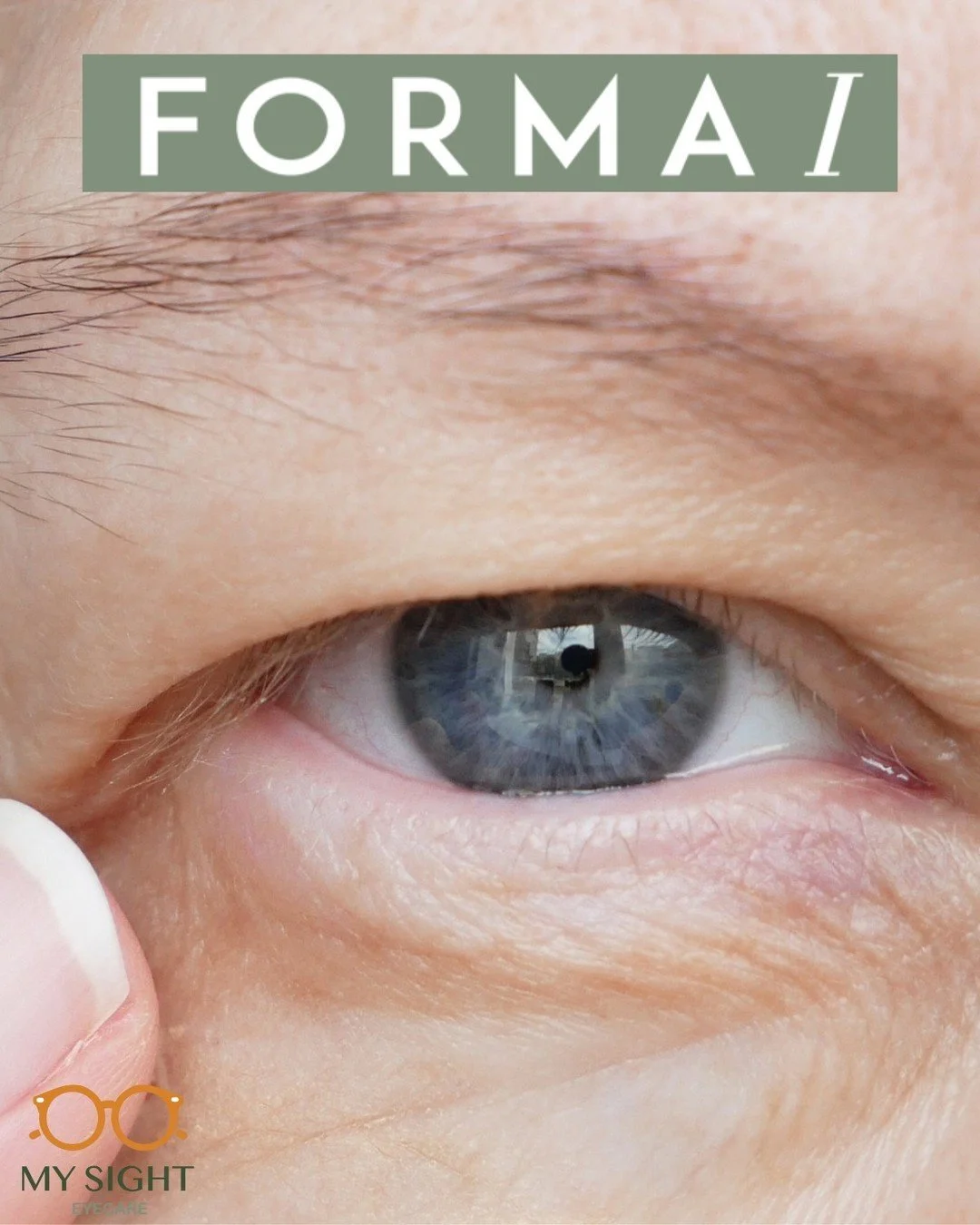 Transform your eye care routine with #FormaI! 

Eyes are the windows to the soul, and we believe they deserve the utmost care and attention. That is why we are thrilled to offer Forma-I treatment to our patients! 

Forma-I uses thermal tissue remodel