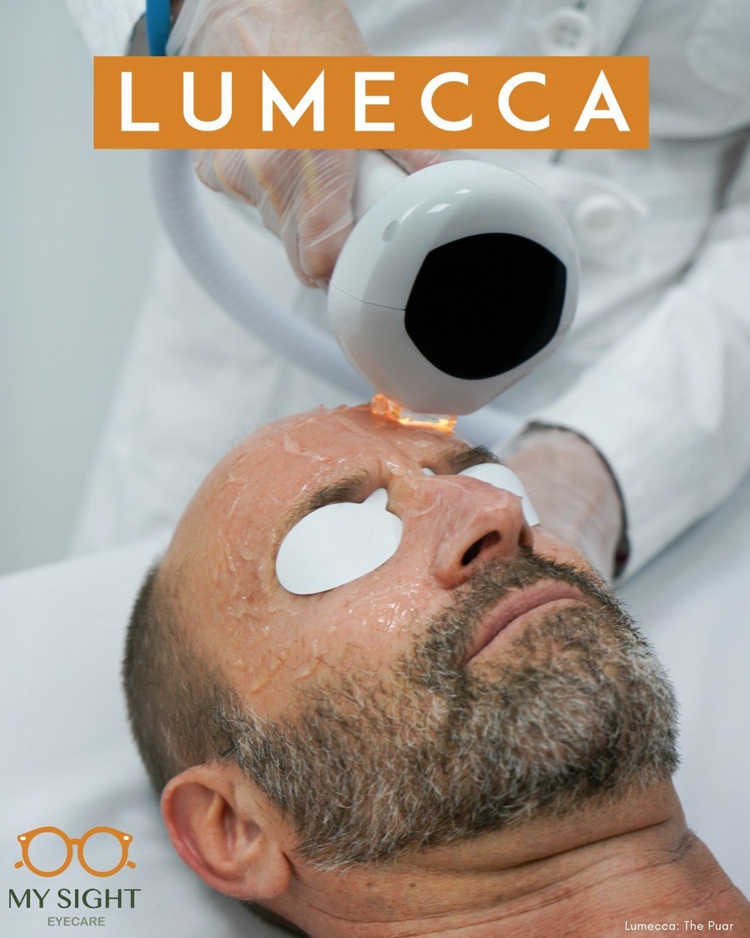 In just 1-3 sessions #Lumecca improves the appearance of:

🌞Age spots (red/brown pigmentations)
🌞Vascular lesions such as facial telangiectasias (spider veins)
🌞Rosacea (redness)
🌞Freckles
🌞Sun damage

Check out the link in our profile or call 7