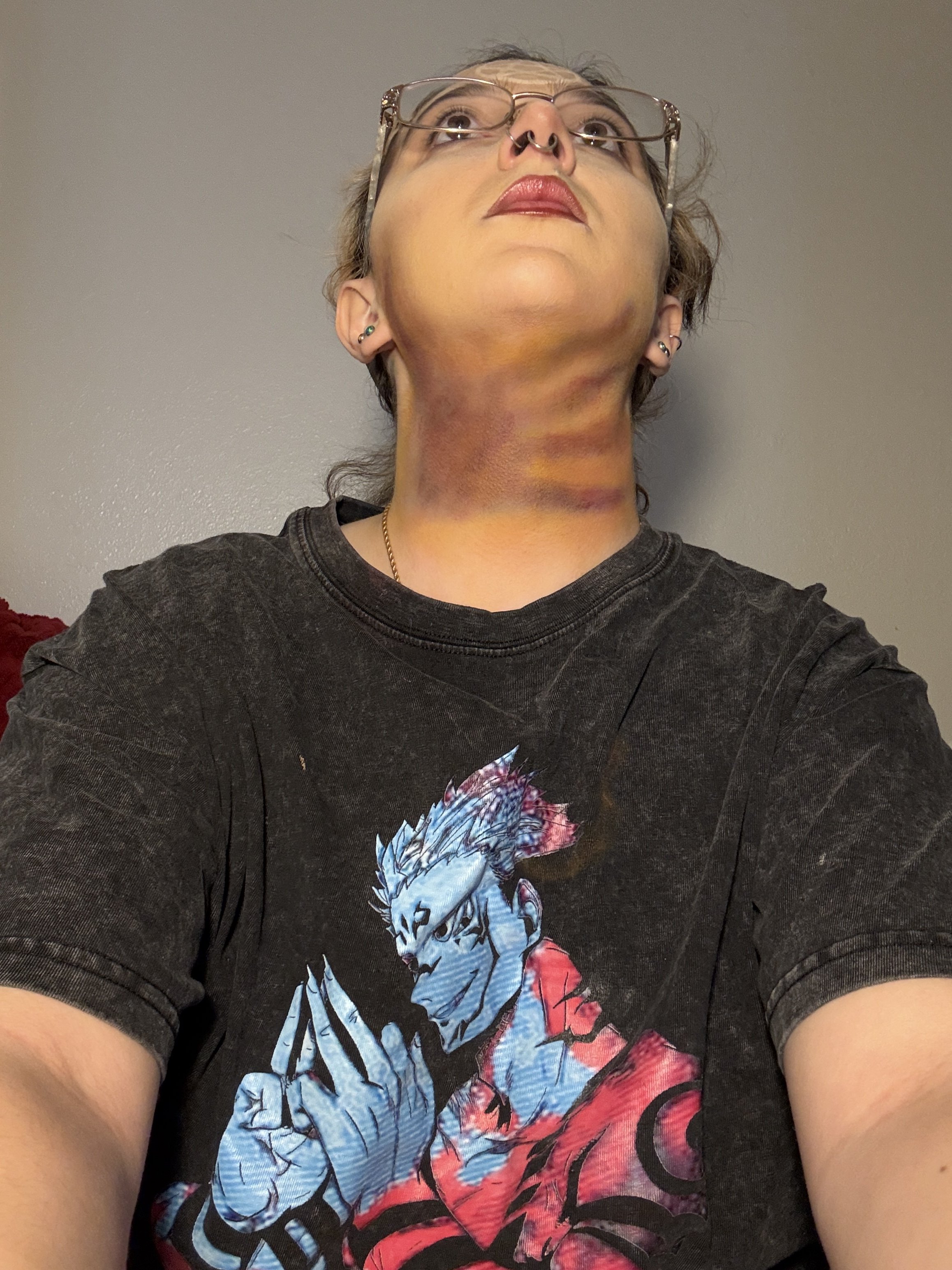 Bruise 4.JPG