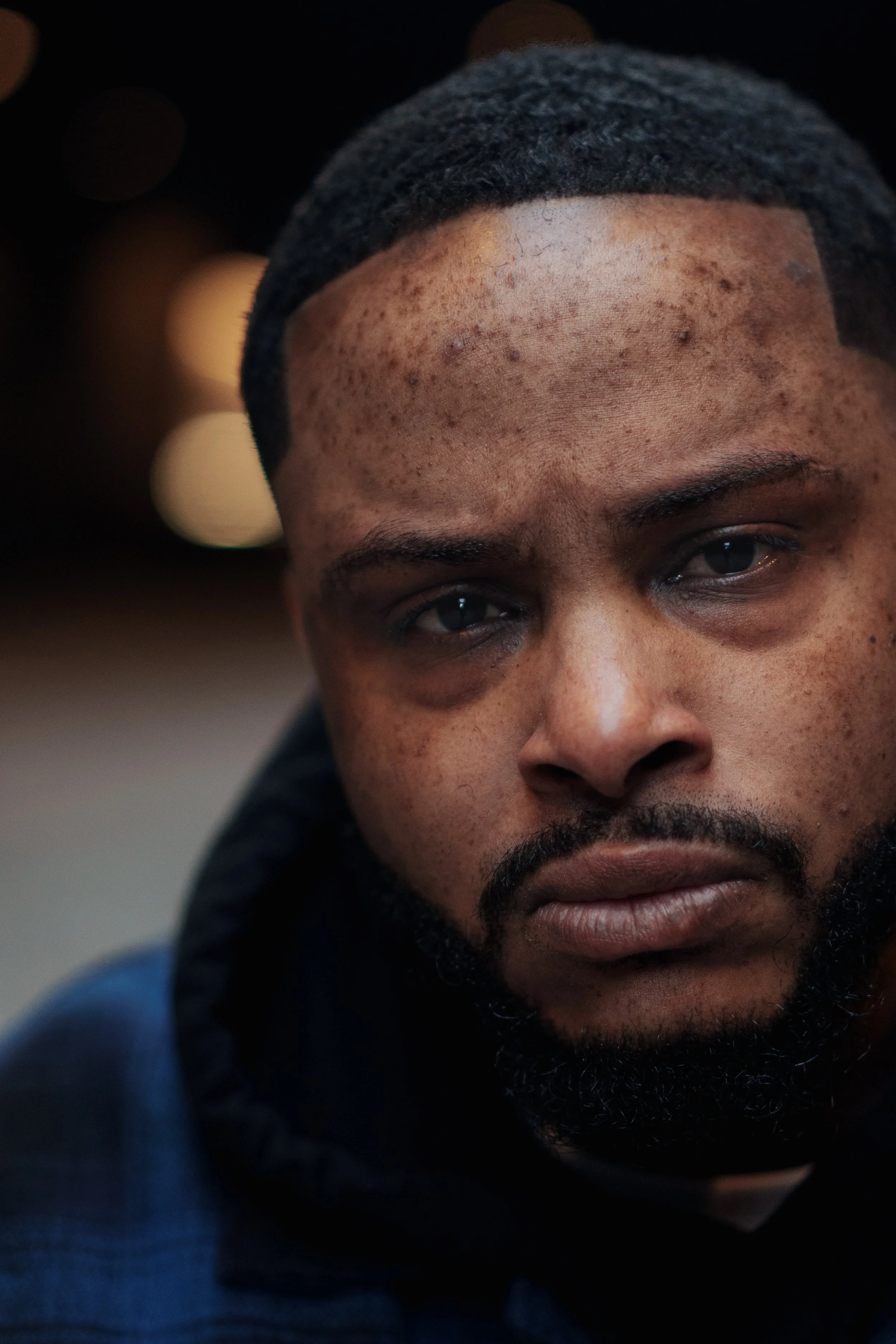 Close-up of a young man's face focusing on his forehead, eyes, and facial hair with a blurred background.