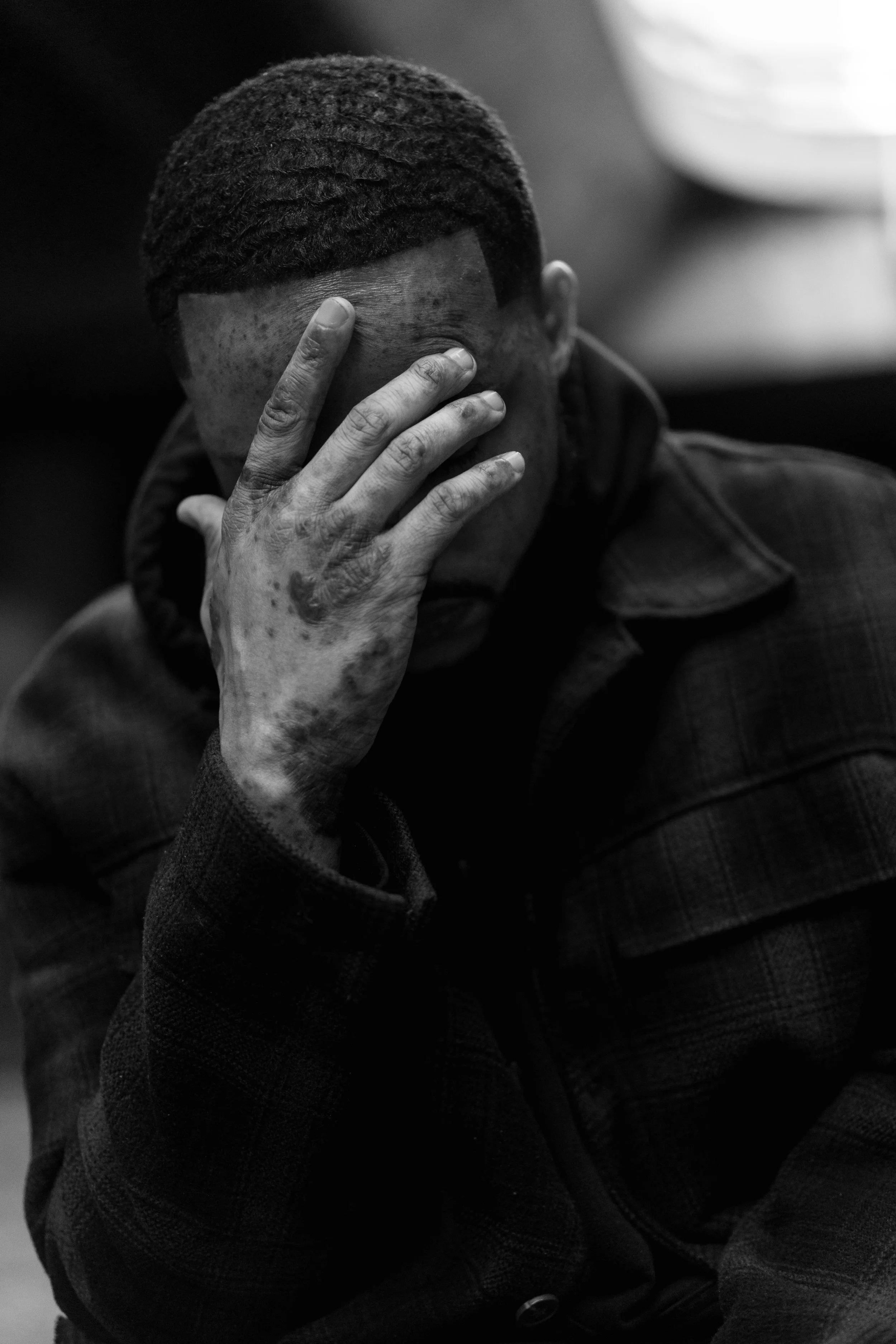 A person with short, textured hair, covering their face with their hand, wearing a dark jacket, in a black and white photograph.