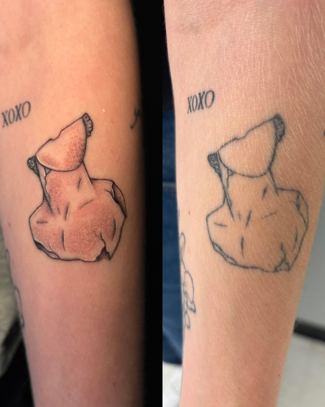 Tattoo of a broken peach with the words 'XOXO' above it, shown before and after removal or cover-up.